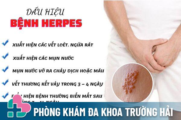 Dấu hiệu nhận biết bệnh Herpes nên lưu ý