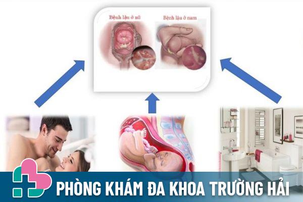 Các con đường lây nhiễm bệnh lậu