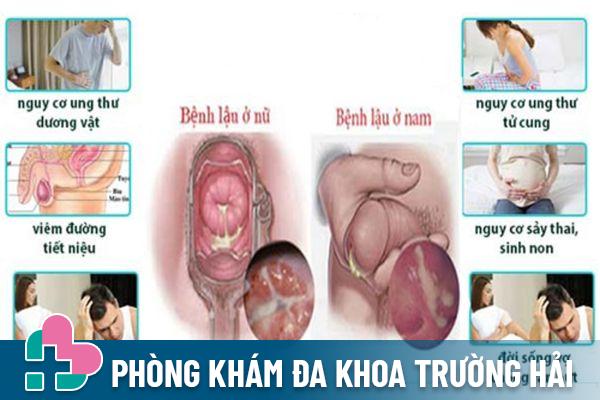 Bệnh lậu là bệnh tình dục phổ biến nhất