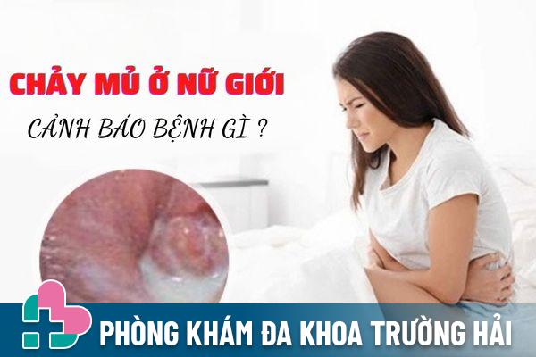 Chảy mủ ở nữ giới – Cảnh báo các bệnh lý nguy hiểm không nên bỏ qua