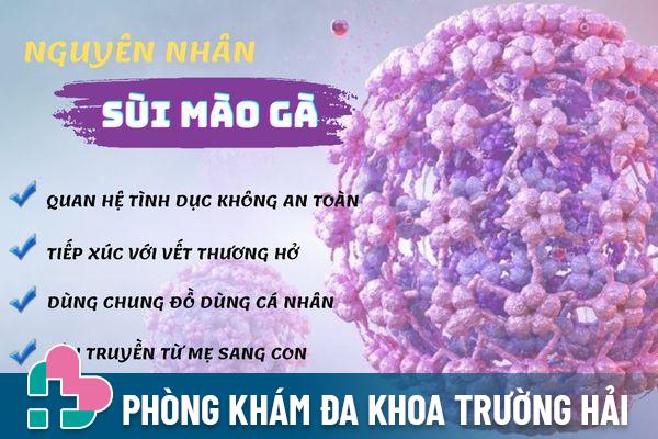 Sùi mào gà lây nhiễm qua nhiều con đường khác nhau