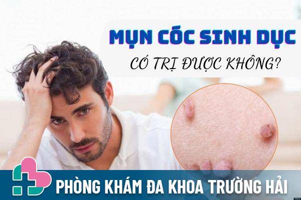 Mụn cóc sinh dục là bệnh gì? Có chữa trị được không?