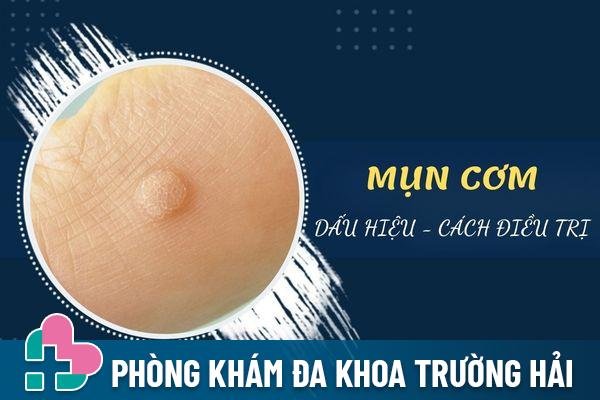 Mụn cơm là gì? Triệu chứng và cách điều trị hiệu quả