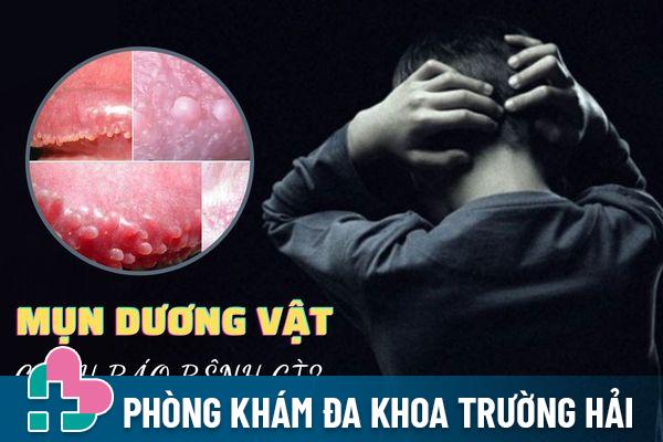 Xuất hiện mụn dương vật bị bệnh gì? Có nguy hiểm không?