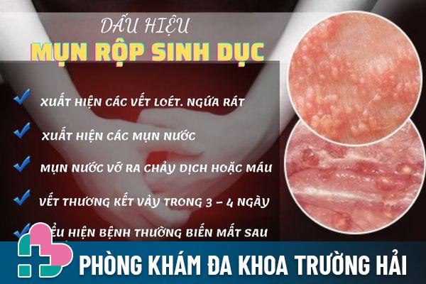 Dấu hiệu nhận biết mụn rộp sinh dục