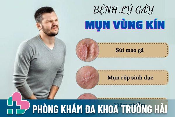 Các bệnh lý phổ biến gây nổi mụn vùng kín