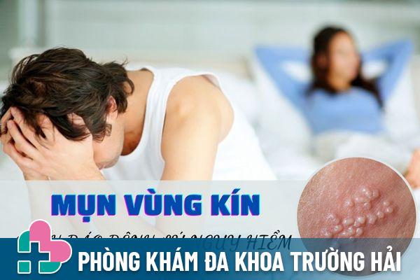 Nổi mụn vùng kín – Dấu hiệu cảnh báo nhiều bệnh lý nguy hiểm