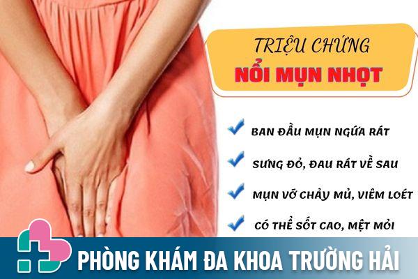 Các dấu hiệu nhận biết nổi mụn nhọt phổ biến nhất