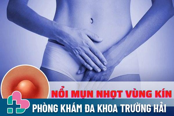 Tại sao nổi mụn nhọt ở vùng kín – Cách điều trị hiệu quả