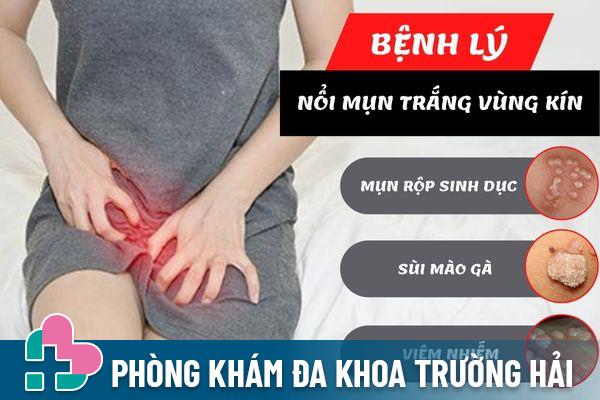 Nổi mụn trắng cảnh báo nhiều bệnh lý khác nhau