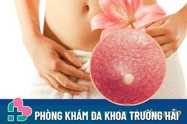 Nổi mụn trắng bất thường ở vùng kín là bị bệnh gì?