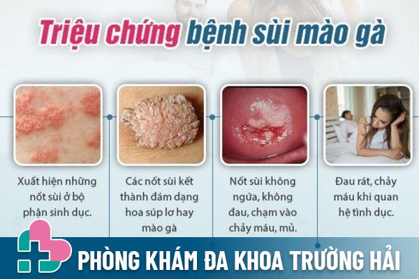 Sùi mào gà có nhiều dấu hiệu nhận biết khác nhau