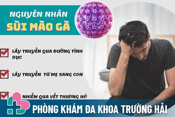 Sùi mào gà lây truyền qua nhiều con đường khác nhau