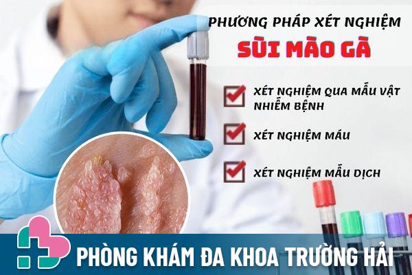 Các phương pháp xét nghiệm sùi mào gà hiệu quả