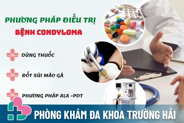 Phương pháp điều trị bệnh Condyloma hiệu quả