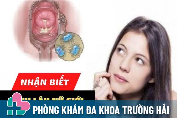 Triệu chứng bệnh lậu nữ giới và cách điều trị hiệu quả