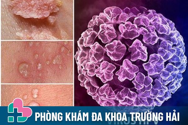 Sùi mào gà do virus HPV gây nên