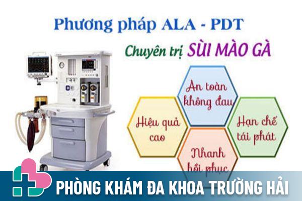 Điều trị sùi mào gà bằng phương pháp ALA - PDT