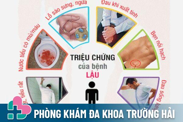 Triệu chứng bệnh lậu ở nam giới