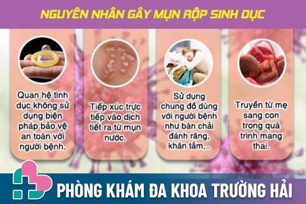 Bệnh mụn rộp sinh dục lây nhiễm qua nhiều con đường khác nhau