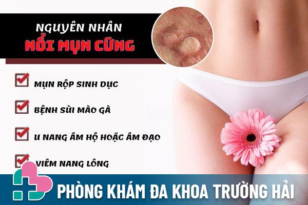 Nổi mụn cứng là dấu hiệu cảnh báo của nhiều bệnh lý khác nhau