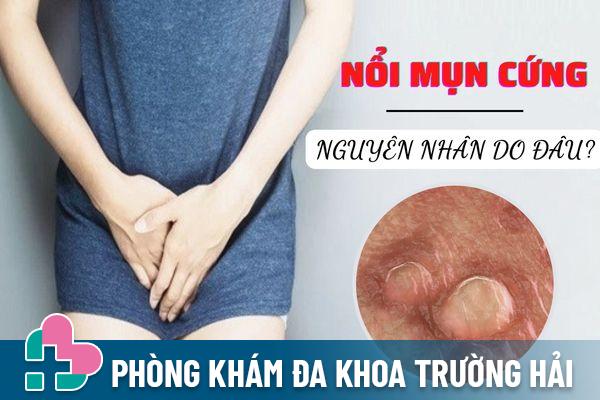 Vùng kín nổi mụn cứng – Dấu hiệu không nên xem thường