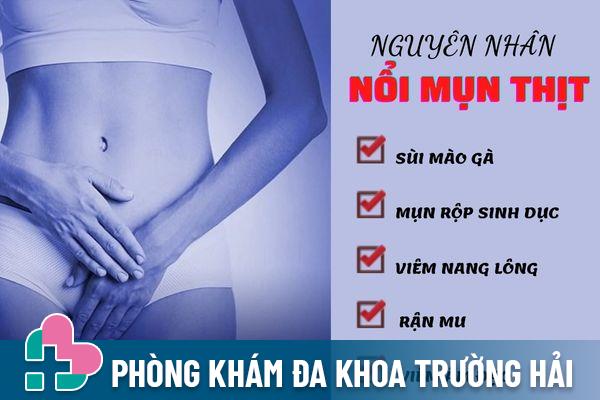 Nổi mụn thịt vùng kín cảnh báo cho nhiều bệnh lý nguy hiểm