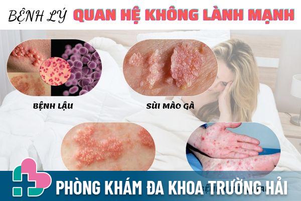 Quan hệ không lành mạnh gây ra nhiều bệnh xã hội nguy hiểm