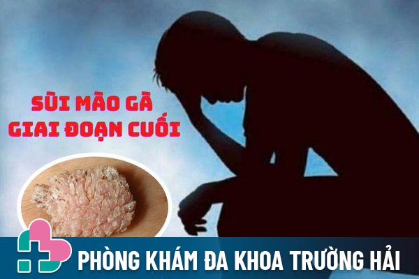 Nhận biết sùi mào gà giai đoạn cuối – Cách điều trị hiệu quả