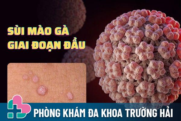 Sùi mào gà giai đoạn đầu – Phát hiện sớm, điều trị hiệu quả