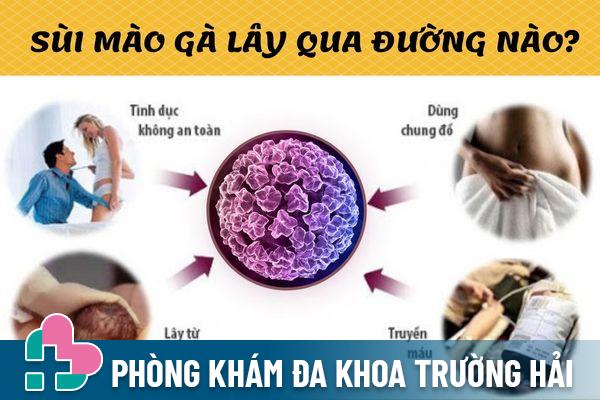 Sùi mào gà có khả năng lây nhiễm cao qua nhiều con đường khác nhau