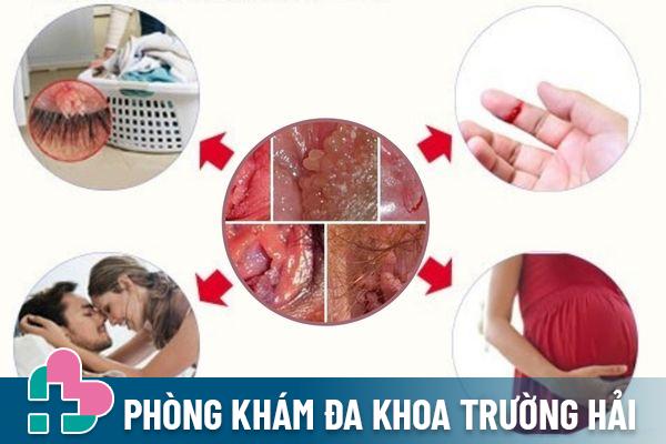 Các con đường lây nhiễm sùi mào gà âm đạo ở nữ giới