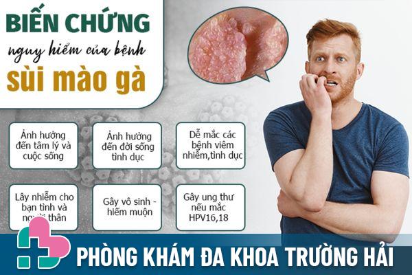 Biến chứng của bệnh sùi mào gà ở nam giới