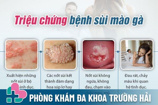 Dấu hiệu nhận biết sùi mào gà ở nữ