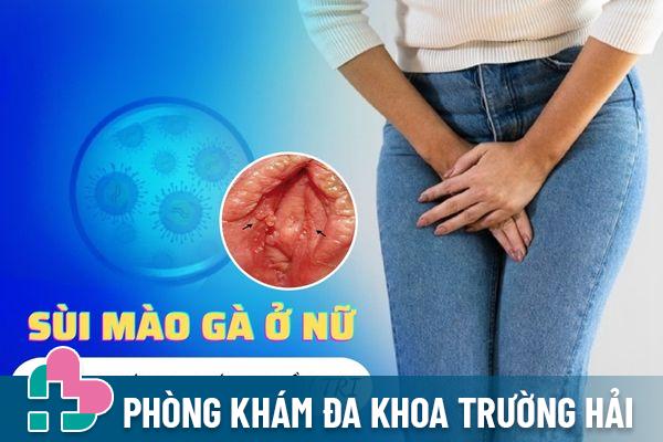 Dấu hiệu nhận biết sùi mào gà ở nữ – Cách điều trị hiệu quả