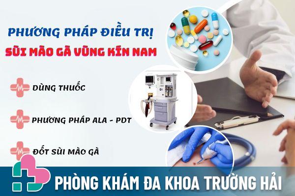 Phương pháp điều trị sùi mào gà vùng kín nam hiệu quả