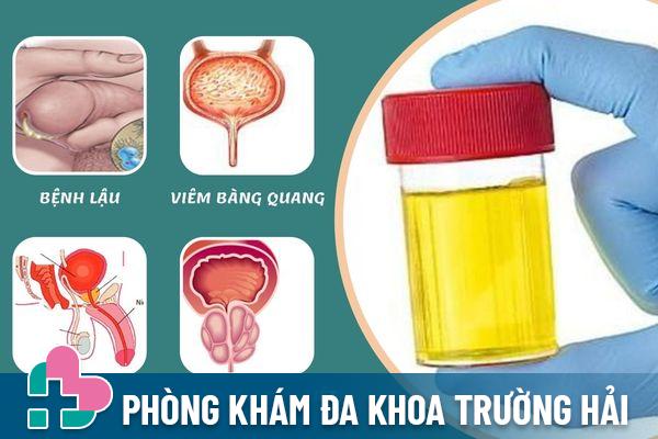 Tiểu có mủ là dấu hiệu cảnh báo của nhiều bệnh lý khác nhau