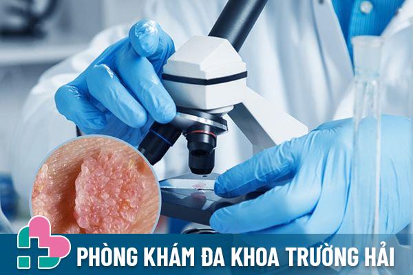 Xét nghiệm bệnh HPV bằng mẫu vật của người bệnh