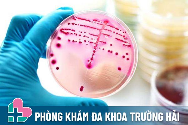 Phương pháp xét nghiệm mẫu vật cho kết quả chính xác