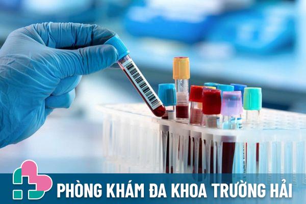 Xét nghiệm máu là phương pháp thông dụng nhất