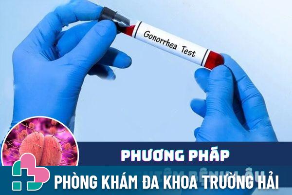 Các phương pháp xét nghiệm bệnh lậu hiệu quả, chuẩn xác