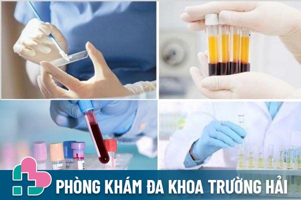 Phương pháp xét nghiệm bệnh xã hội hiệu quả