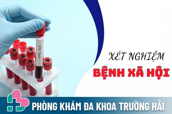 Phương pháp xét nghiệm bệnh xã hội hiệu quả và an toàn