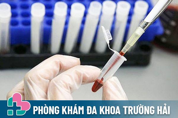 Xét nghiệm máu - Phương pháp phát hiện bệnh giang mai thông dụng