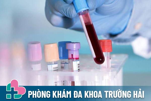 Xét nghiệm máu giúp phát hiện virus HSV