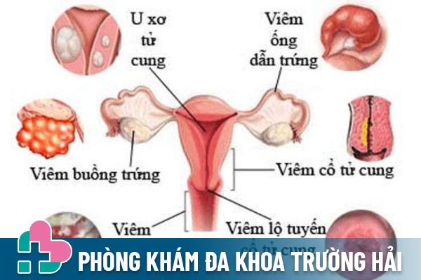 Các bệnh lý phụ khoa gây ra triệu chứng chảy mủ ở âm đạo