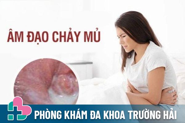 Âm đạo chảy mủ là biểu hiện của bệnh gì? Có nguy hiểm không?