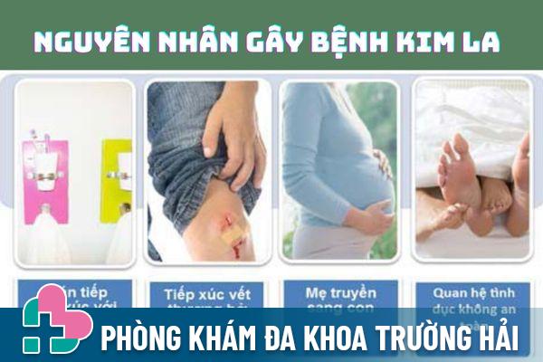 Bệnh kim la có thể lây nhiễm qua nhiều con đường khác nhau