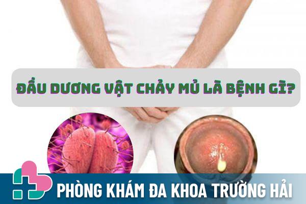 Đầu dương vật chảy mủ – Dấu hiệu cảnh báo bệnh lậu nguy hiểm