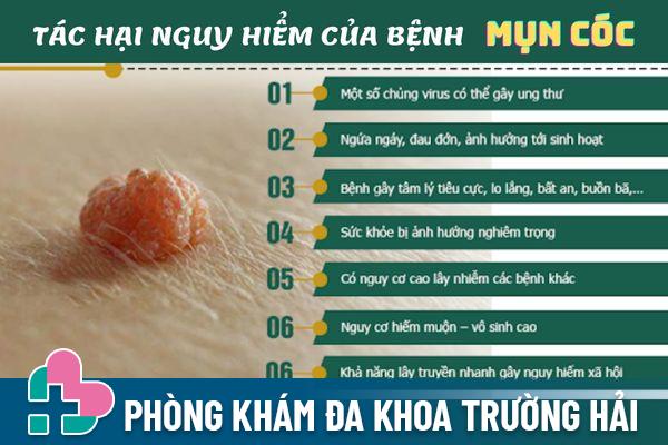 Mụn cóc gây ra nhiều ảnh hưởng nguy hiểm